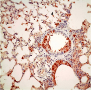 小鼠肺組織感染帶有PB2適應性變異的禽流感病毒，棕色為病毒感染繁殖的細胞。